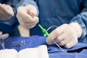 FDA Announces Recall of Inari Medical Catheter 